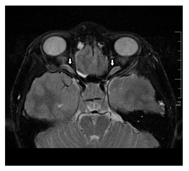https://cdn.ncbi.nlm.nih.gov/pmc/blobs/e6d4/4302350/ae6e535fdb38/CRIOPM2015-420964.003.jpg