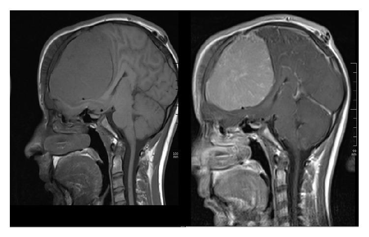 https://cdn.ncbi.nlm.nih.gov/pmc/blobs/e6d4/4302350/ecf8c4867c2b/CRIOPM2015-420964.002.jpg