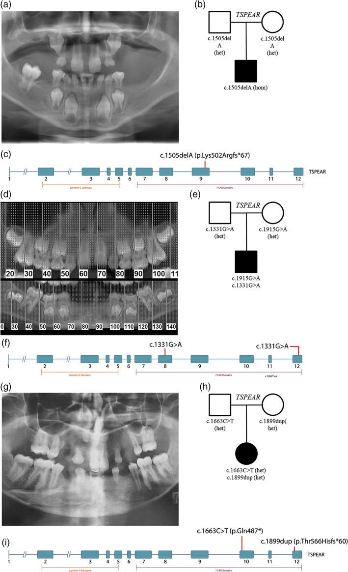 https://cdn.ncbi.nlm.nih.gov/pmc/blobs/e6d4/8361973/75df422b24be/AJMG-185-2417-g002.jpg