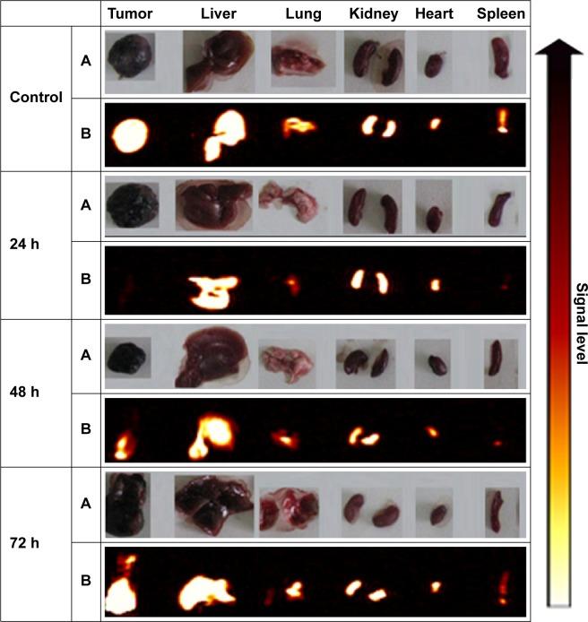 https://cdn.ncbi.nlm.nih.gov/pmc/blobs/e6d8/4854252/0828a50853a2/ijn-11-1779Fig2.jpg