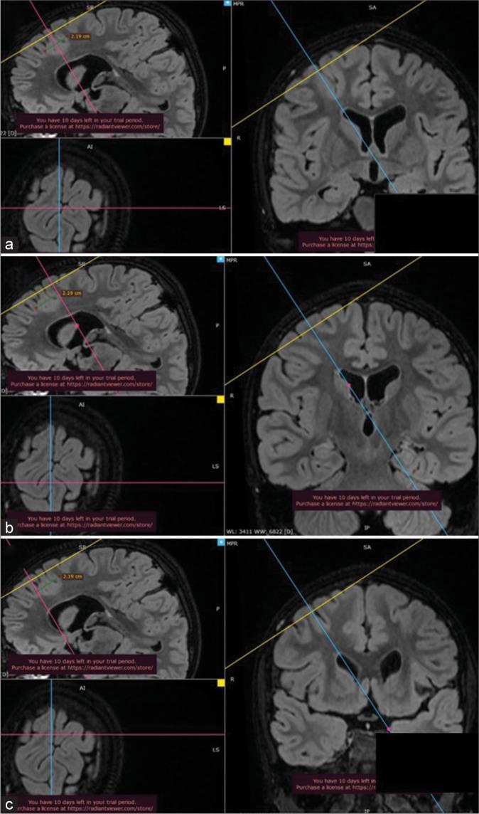 https://cdn.ncbi.nlm.nih.gov/pmc/blobs/e6da/11090566/3135054de694/JNRP-15-361-g002.jpg