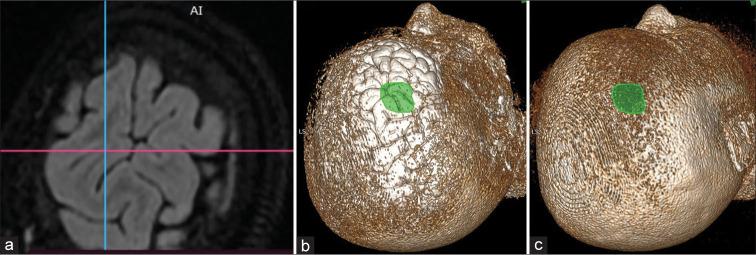 https://cdn.ncbi.nlm.nih.gov/pmc/blobs/e6da/11090566/e33ed455c38e/JNRP-15-361-g003.jpg