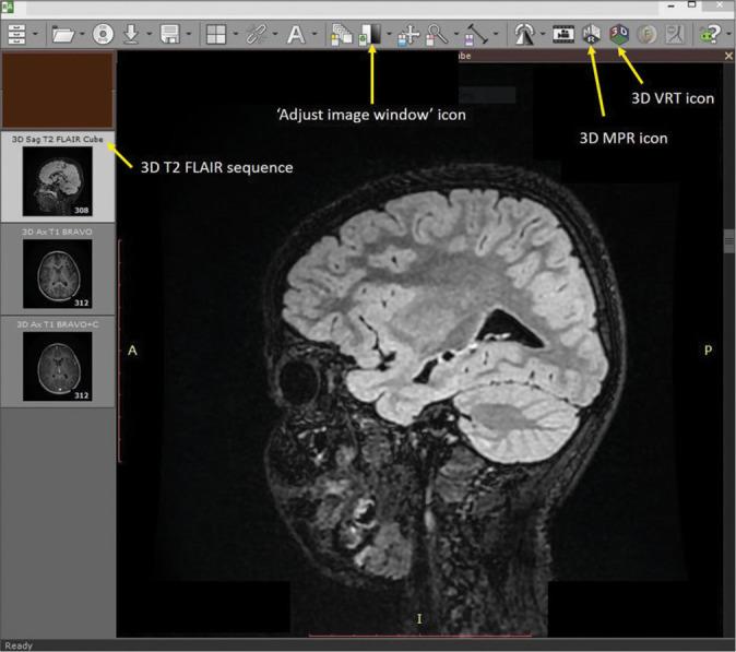 https://cdn.ncbi.nlm.nih.gov/pmc/blobs/e6da/11090566/e7dff322d389/JNRP-15-361-g001.jpg