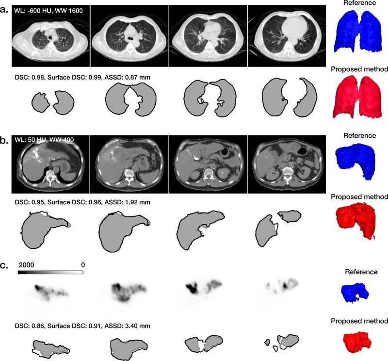 https://cdn.ncbi.nlm.nih.gov/pmc/blobs/e6db/9298038/620afe39d33d/MP-48-7877-g005.jpg