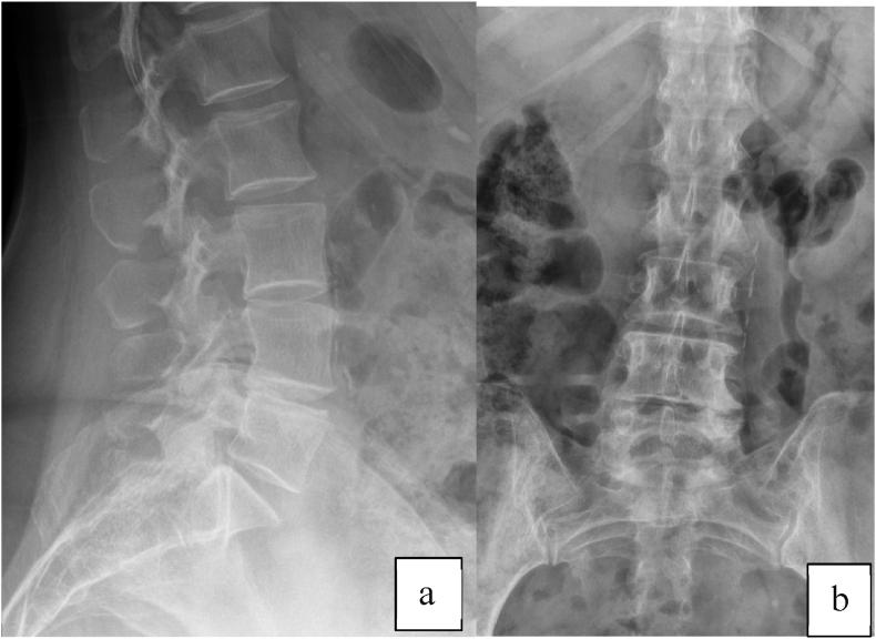 https://cdn.ncbi.nlm.nih.gov/pmc/blobs/e6dc/11703778/0f8380103f41/gr1.jpg