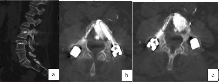 https://cdn.ncbi.nlm.nih.gov/pmc/blobs/e6dc/11703778/10290acaf41b/gr5.jpg