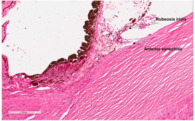 https://cdn.ncbi.nlm.nih.gov/pmc/blobs/e6e0/7610040/562a59b690a9/gr4.jpg