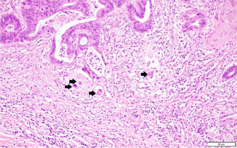 https://cdn.ncbi.nlm.nih.gov/pmc/blobs/e6e1/9357306/c59f2a28c7df/12885_2022_9957_Fig2_HTML.jpg