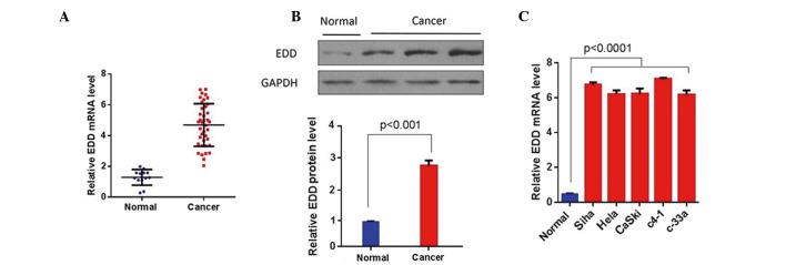 https://cdn.ncbi.nlm.nih.gov/pmc/blobs/e6e2/4950831/9ba198338c63/etm-12-02-0676-g00.jpg