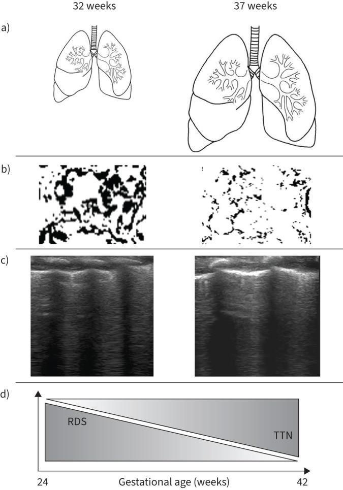 https://cdn.ncbi.nlm.nih.gov/pmc/blobs/e6e3/11795285/86ba495c2ba8/ERR-0112-2024.02.jpg