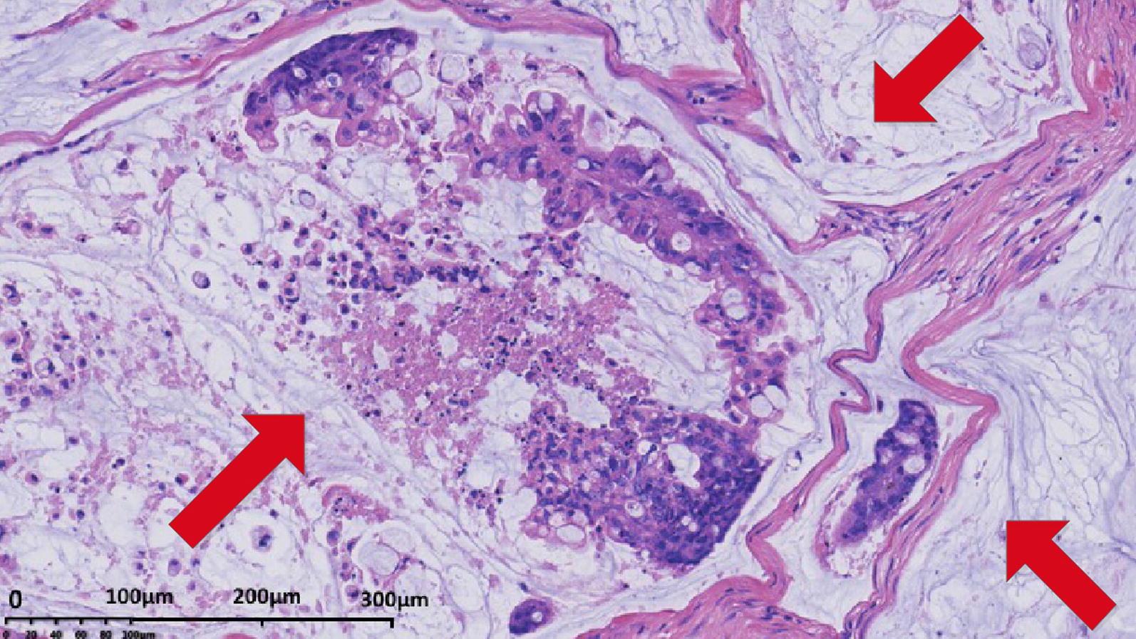 https://cdn.ncbi.nlm.nih.gov/pmc/blobs/e6e3/6440160/5ac658d147e1/40880_2019_361_Fig1_HTML.jpg