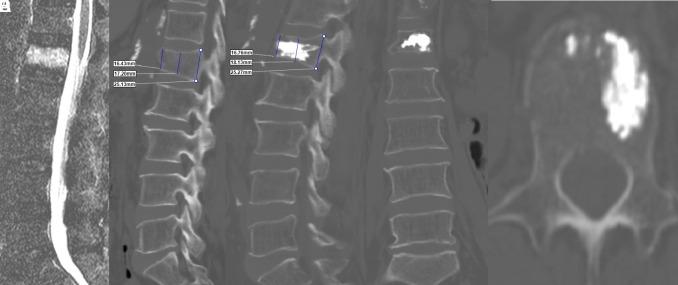 https://cdn.ncbi.nlm.nih.gov/pmc/blobs/e6e6/11992941/5e62d26993ec/aott-59-1-63_f001.jpg