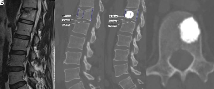 https://cdn.ncbi.nlm.nih.gov/pmc/blobs/e6e6/11992941/a3224b1b9a31/aott-59-1-63_f004.jpg