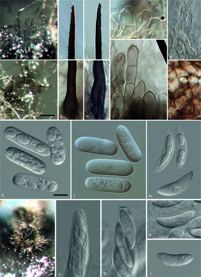 https://cdn.ncbi.nlm.nih.gov/pmc/blobs/e6ea/4312939/d67f5692a572/per-33-083-g005.jpg