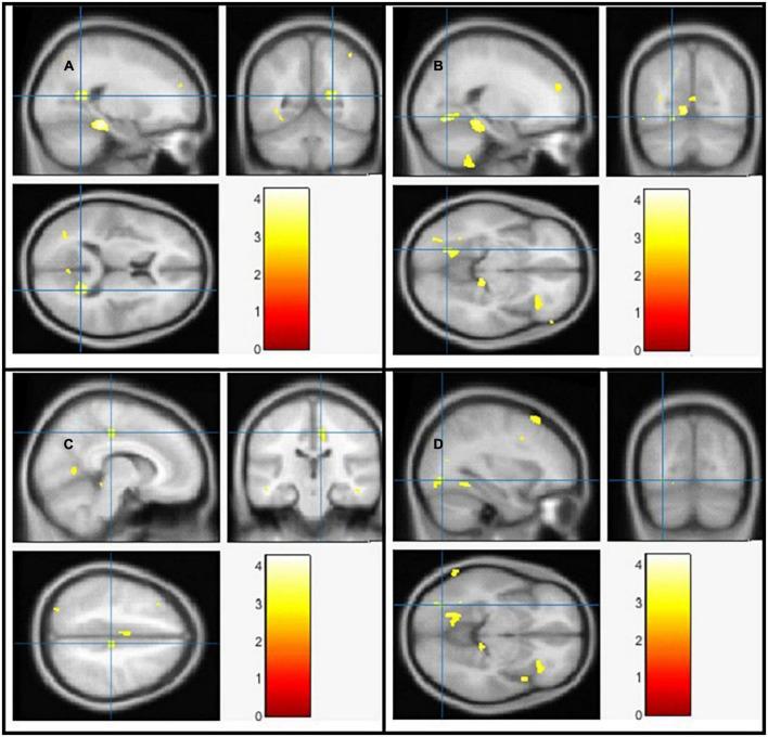 https://cdn.ncbi.nlm.nih.gov/pmc/blobs/e6ea/9618656/bd09884ad968/fpsyt-13-1027907-g003.jpg