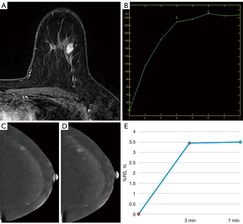 https://cdn.ncbi.nlm.nih.gov/pmc/blobs/e6f3/11320531/67603c94b506/qims-14-08-5541-f6.jpg