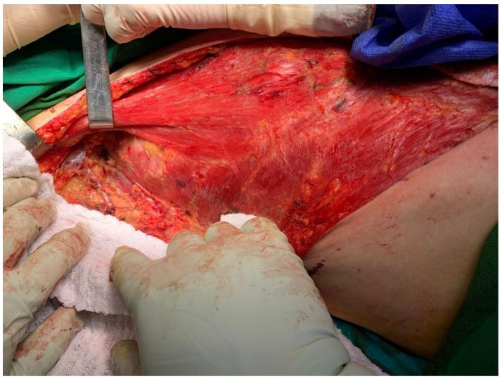 https://cdn.ncbi.nlm.nih.gov/pmc/blobs/e6f3/11640605/26a6de2a3d70/diagnostics-14-02699-g004.jpg