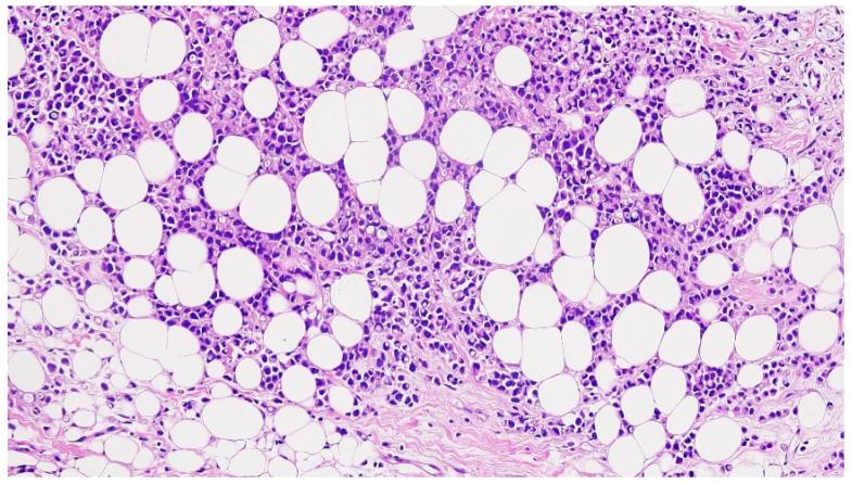 https://cdn.ncbi.nlm.nih.gov/pmc/blobs/e6f3/11640605/8dad2743e220/diagnostics-14-02699-g002.jpg