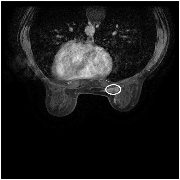 https://cdn.ncbi.nlm.nih.gov/pmc/blobs/e6f3/11640605/a25a85f0b161/diagnostics-14-02699-g001.jpg