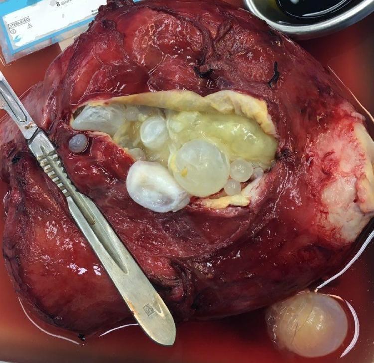 https://cdn.ncbi.nlm.nih.gov/pmc/blobs/e6fd/5985249/e93c843c1496/gr3.jpg