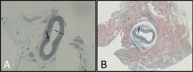 https://cdn.ncbi.nlm.nih.gov/pmc/blobs/e704/5516050/1c8fac33538d/jcvtr-9-108-g003.jpg