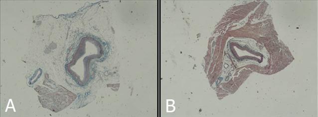 https://cdn.ncbi.nlm.nih.gov/pmc/blobs/e704/5516050/78d7efcac962/jcvtr-9-108-g002.jpg