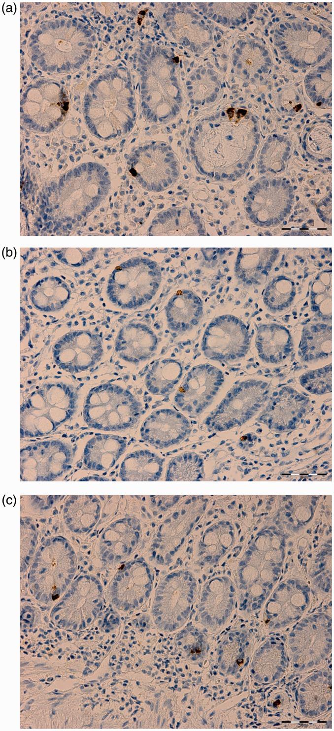 https://cdn.ncbi.nlm.nih.gov/pmc/blobs/e707/5528999/c02ec0c7c57d/10.1177_1535370217699537-fig7.jpg