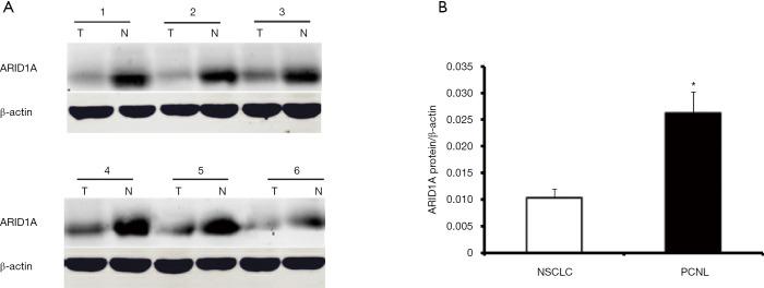 https://cdn.ncbi.nlm.nih.gov/pmc/blobs/e70a/8798606/7820e5f71813/tcr-09-08-4896-f2.jpg