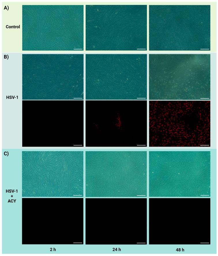 https://cdn.ncbi.nlm.nih.gov/pmc/blobs/e70e/11352947/386c677c9dd7/biosensors-14-00401-g003.jpg