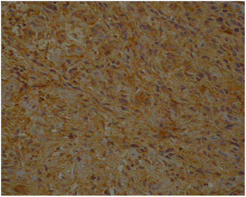 https://cdn.ncbi.nlm.nih.gov/pmc/blobs/e70f/7141524/6a4327c95de4/jcm-09-00867-g007.jpg