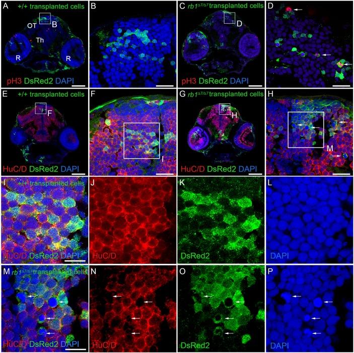 https://cdn.ncbi.nlm.nih.gov/pmc/blobs/e710/6031359/b83e6b5195fc/dmm-11-034124-g3.jpg