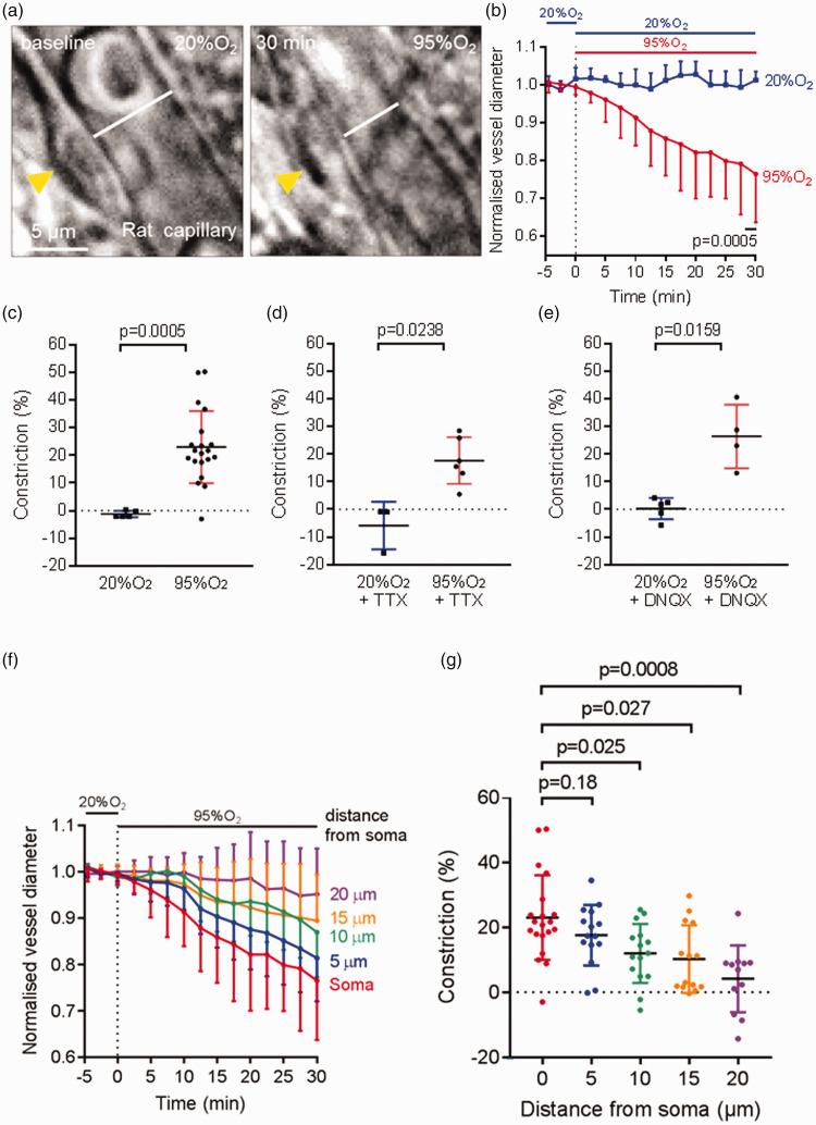 https://cdn.ncbi.nlm.nih.gov/pmc/blobs/e710/9580167/4e3b3713491c/10.1177_0271678X221111598-fig1.jpg
