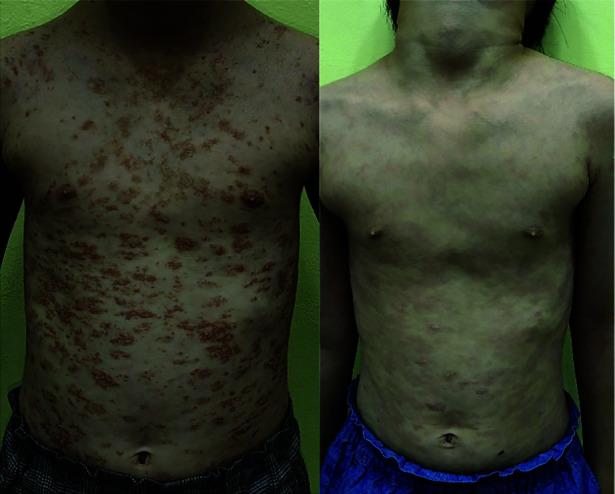 https://cdn.ncbi.nlm.nih.gov/pmc/blobs/e716/10615329/1f0ad4614cfe/dic-2023-8-2_LEUNG_figure5.jpg