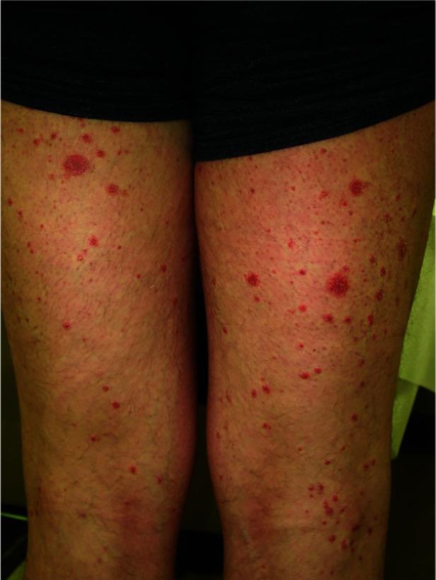 https://cdn.ncbi.nlm.nih.gov/pmc/blobs/e716/10615329/8b6a8fd1184d/dic-2023-8-2_LEUNG_figure2.jpg