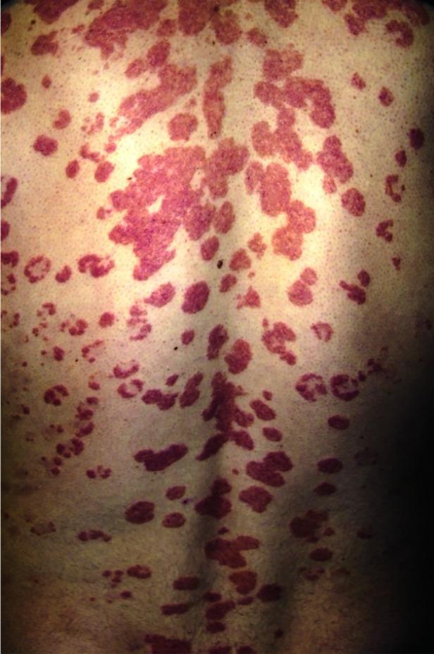 https://cdn.ncbi.nlm.nih.gov/pmc/blobs/e716/10615329/8e6aca70eaf0/dic-2023-8-2_LEUNG_figure1.jpg