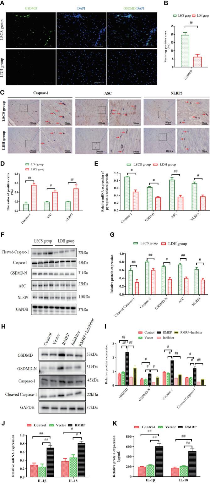 https://cdn.ncbi.nlm.nih.gov/pmc/blobs/e719/11362830/b4dbd2c40fc0/fimmu-15-1427970-g004.jpg