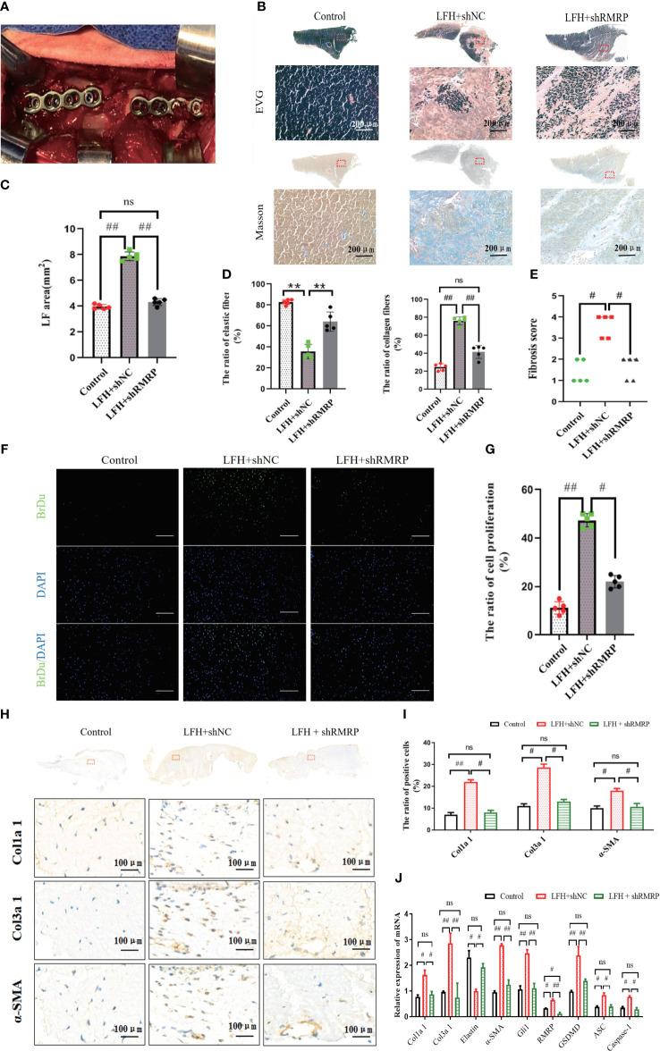 https://cdn.ncbi.nlm.nih.gov/pmc/blobs/e719/11362830/fd0264777b40/fimmu-15-1427970-g005.jpg