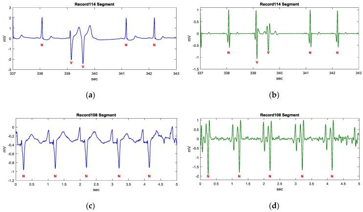 https://cdn.ncbi.nlm.nih.gov/pmc/blobs/e71e/5621148/2951f1e7e3e8/sensors-17-01969-g006a.jpg