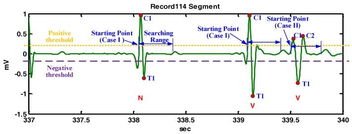 https://cdn.ncbi.nlm.nih.gov/pmc/blobs/e71e/5621148/fa0f68024f0a/sensors-17-01969-g008.jpg