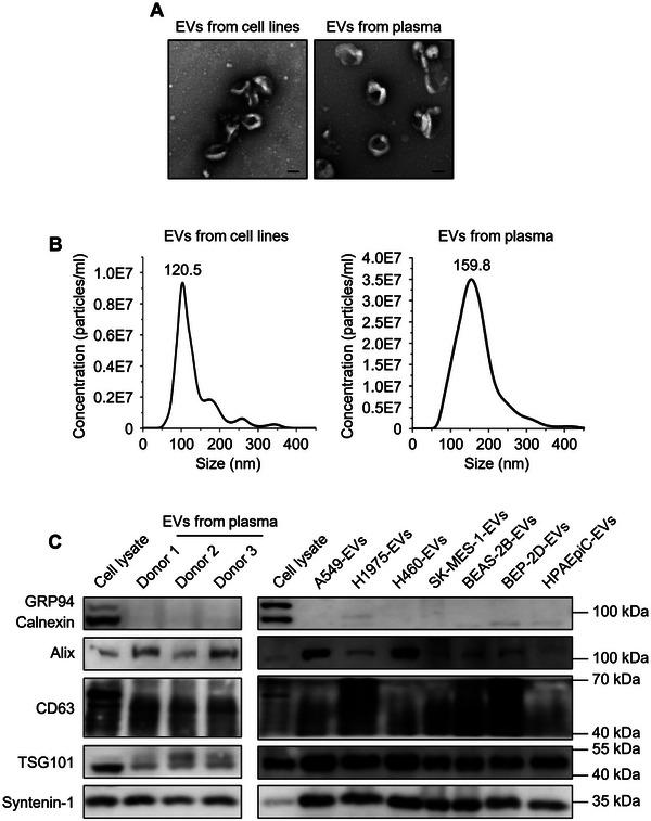 https://cdn.ncbi.nlm.nih.gov/pmc/blobs/e722/12077270/ff13cae0bfc2/JEV2-14-e70078-g008.jpg