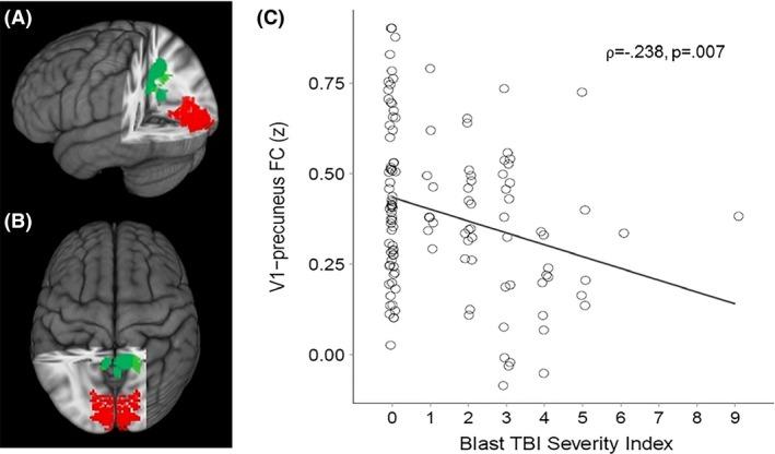 https://cdn.ncbi.nlm.nih.gov/pmc/blobs/e725/4873652/6e58aaf92448/BRB3-6-e00454-g002.jpg
