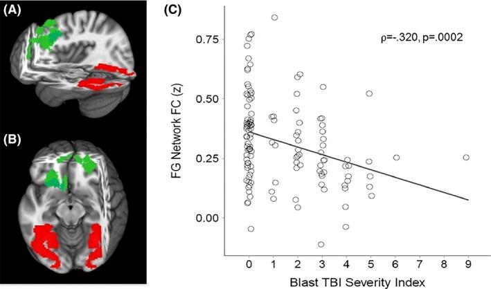 https://cdn.ncbi.nlm.nih.gov/pmc/blobs/e725/4873652/f48b06a0ebd8/BRB3-6-e00454-g004.jpg