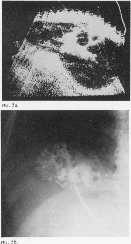 https://cdn.ncbi.nlm.nih.gov/pmc/blobs/e726/1552853/bc58a3dfd457/gut00695-0073-a.jpg