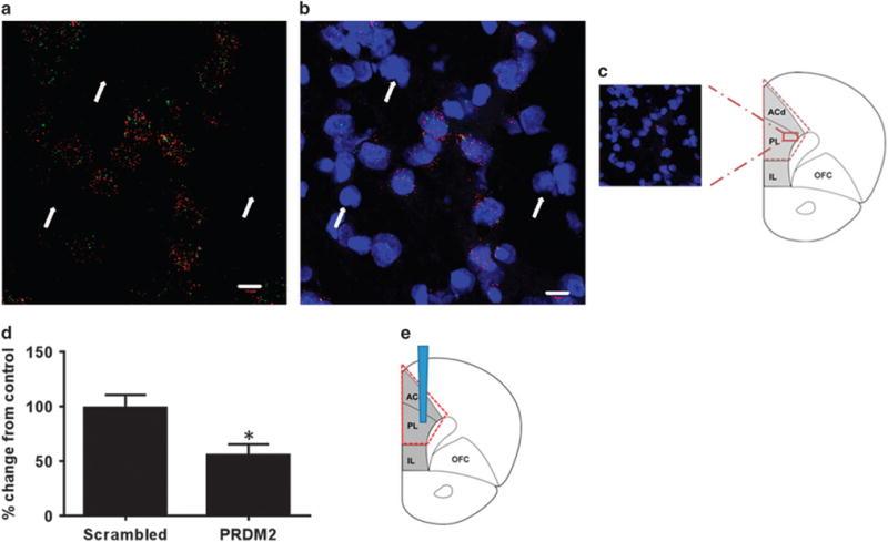 https://cdn.ncbi.nlm.nih.gov/pmc/blobs/e72a/5677579/7f8fac5dca68/nihms891239f4.jpg