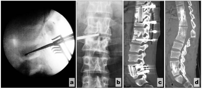 https://cdn.ncbi.nlm.nih.gov/pmc/blobs/e72a/6284173/3811c9d21502/CHSJ-43-02-08-fig3.jpg