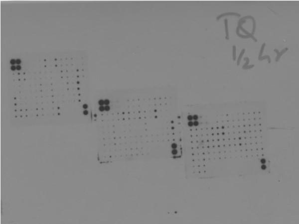 https://cdn.ncbi.nlm.nih.gov/pmc/blobs/e72d/2909169/f6804f816b52/1756-9966-29-87-7.jpg