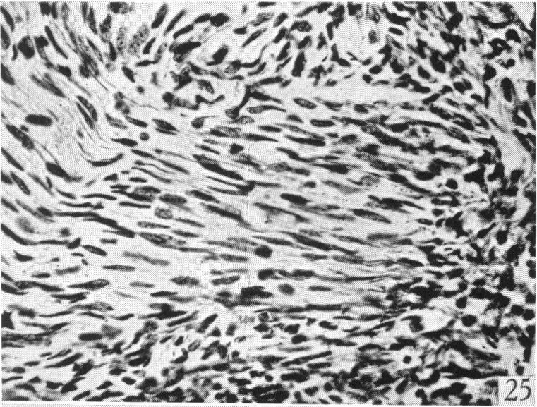 https://cdn.ncbi.nlm.nih.gov/pmc/blobs/e736/1252767/179310a7dd53/janat00506-0059-d.jpg