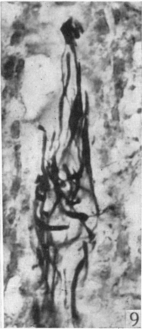https://cdn.ncbi.nlm.nih.gov/pmc/blobs/e736/1252767/3aa21df056c6/janat00506-0057-i.jpg