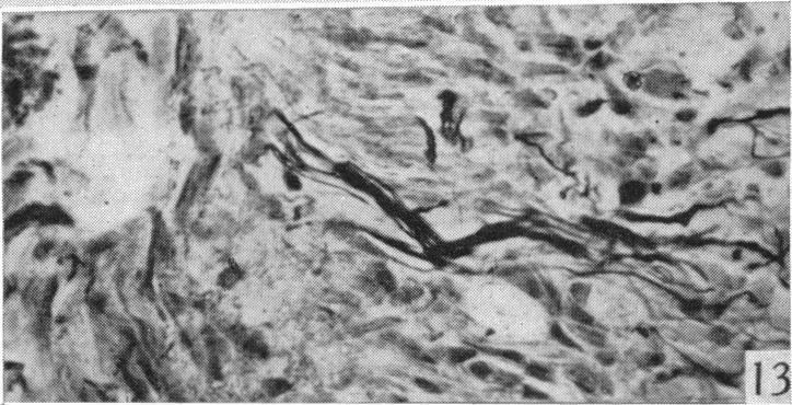https://cdn.ncbi.nlm.nih.gov/pmc/blobs/e736/1252767/63c0c1b5d927/janat00506-0058-d.jpg