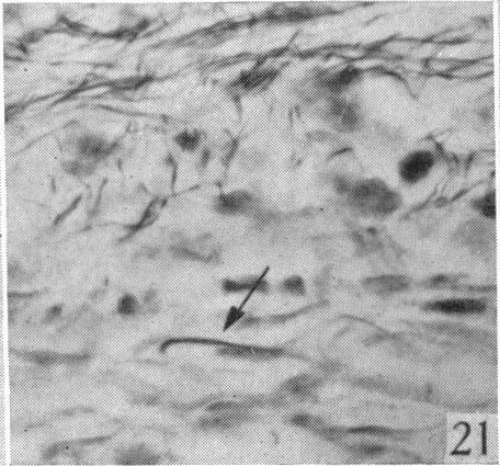 https://cdn.ncbi.nlm.nih.gov/pmc/blobs/e736/1252767/7e2bb49a5fb4/janat00506-0058-l.jpg